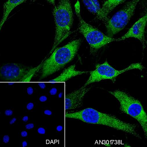 Recombinant CRMP2 Monoclonal Antibody - small - 5