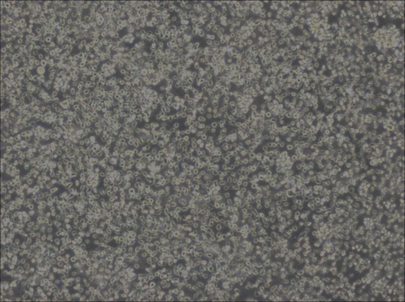 MEC-1 Cell Complete Medium - 3