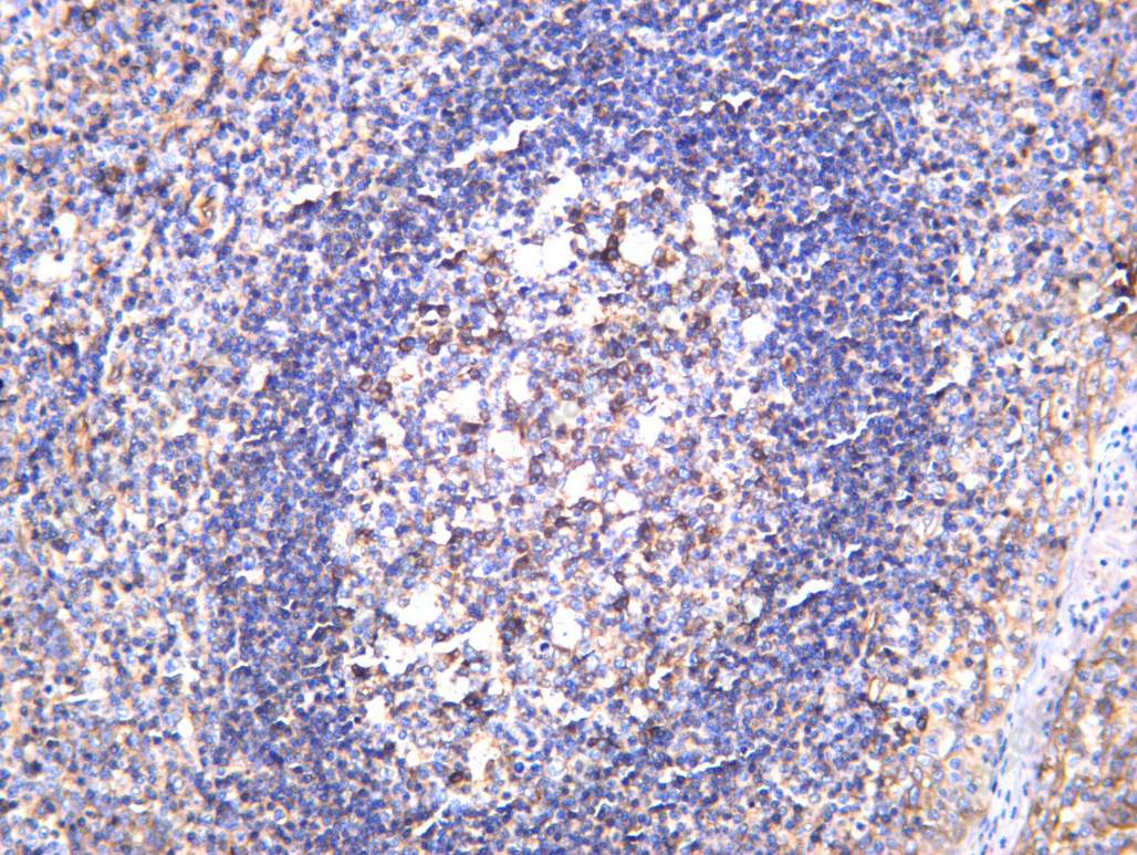 Recombinant CD46 Monoclonal Antibody - 2