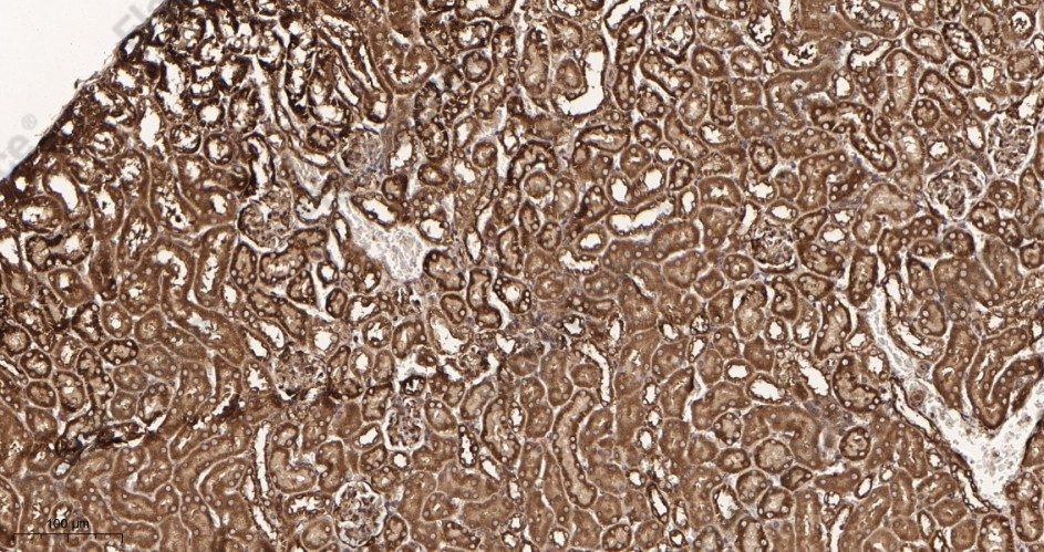 Recombinant Bad Monoclonal Antibody - 3