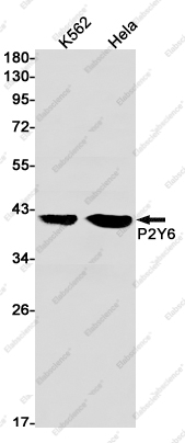 Recombinant P2Y6 Monoclonal Antibody - 1