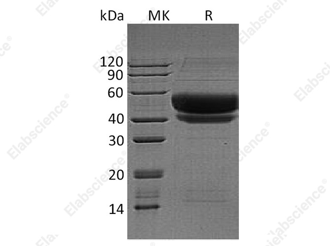 Recombinant Human ST6GAL1 Protein (His Tag) - 1