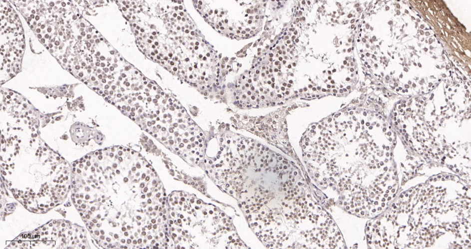 Recombinant METTL3 Monoclonal Antibody - small - 2