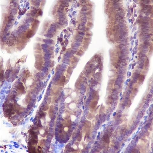 Recombinant Bid Monoclonal Antibody - 3