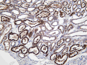 Recombinant ANAG Monoclonal Antibody - 1