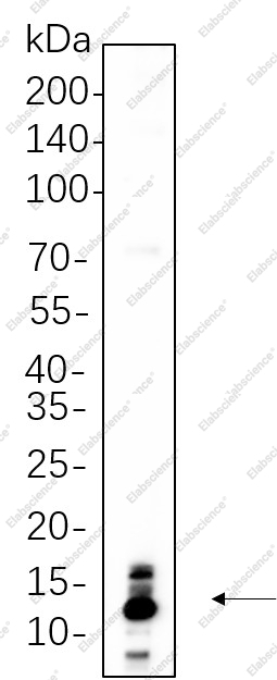 Recombinant S100B Monoclonal Antibody - 1