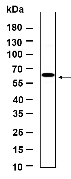 Recombinant Phospho-p70 S6 kinase β (Ser371) Monoclonal Antibody-searchlist-1