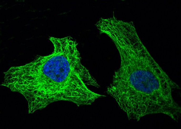 Cytokeratin 8 Monoclonal Antibody - small - 5