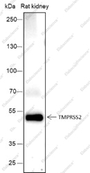 Recombinant TMPRSS2 Monoclonal Antibody - 1
