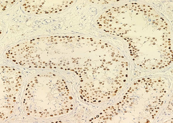PARP/PARP1 Monoclonal Antibody-searchlist-1