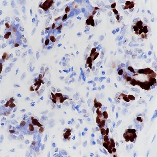 Recombinant Progesterone Receptor Monoclonal Antibody-searchlist-1