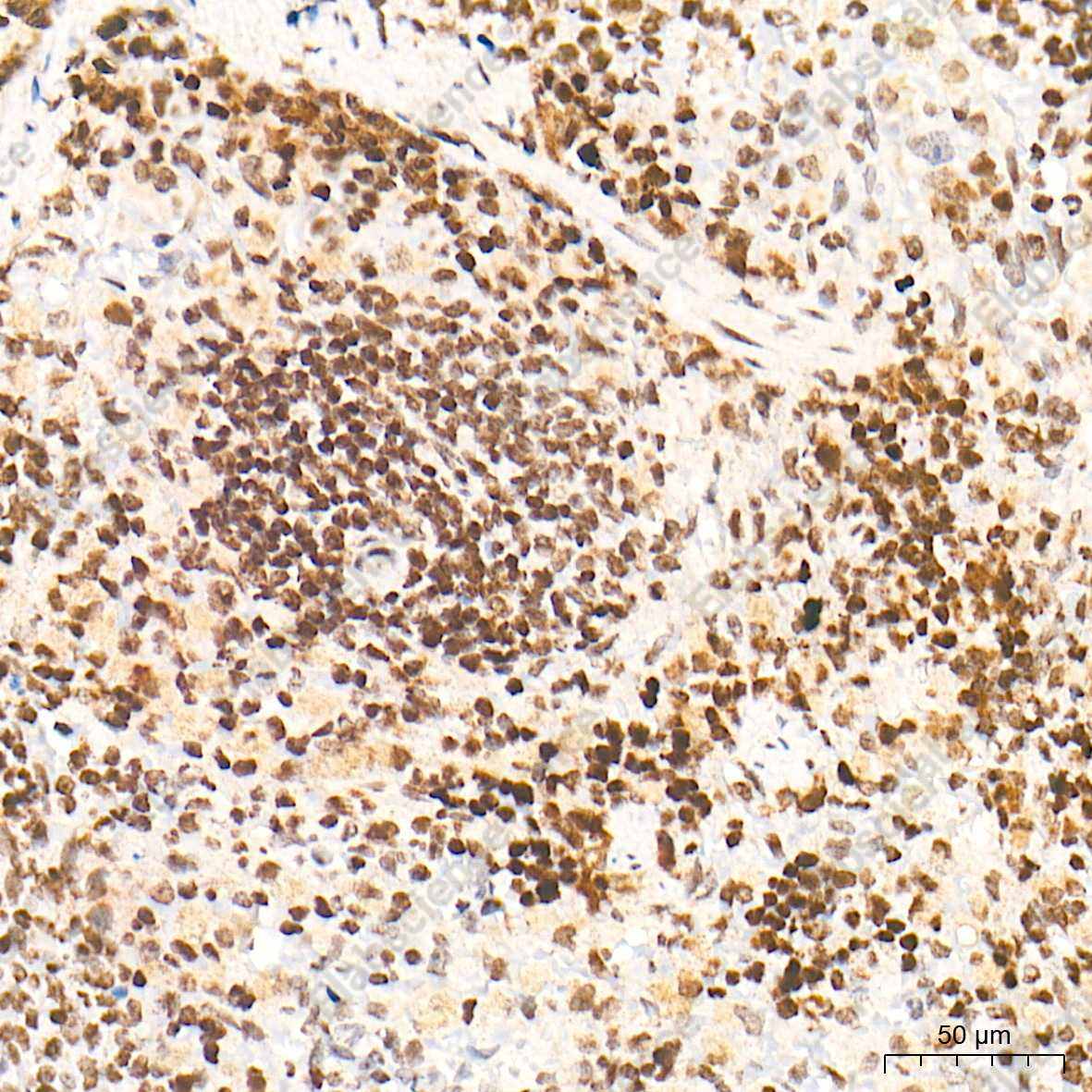 VDR Polyclonal Antibody - 5