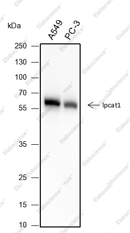 Recombinant LPCAT1 Monoclonal Antibody - 1