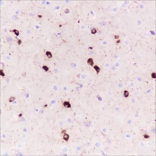 Recombinant Alpha B Crystallin Monoclonal Antibody - small - 4