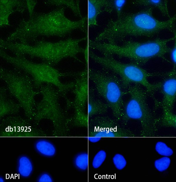 Recombinant beta-Catenin/CTNNB1 Monoclonal Antibody - small - 4