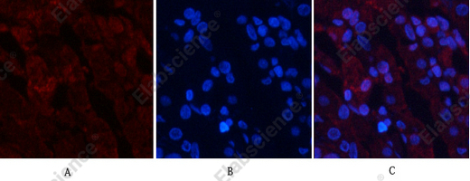Recombinant Phospho-Akt (Thr308) Monoclonal Antibody - 3