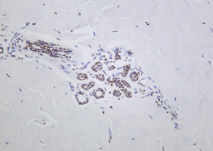Recombinant Histone H2A.Z Monoclonal Antibody-searchlist-1