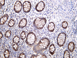 Recombinant Peroxiredoxin- 2 Monoclonal Antibody - 1