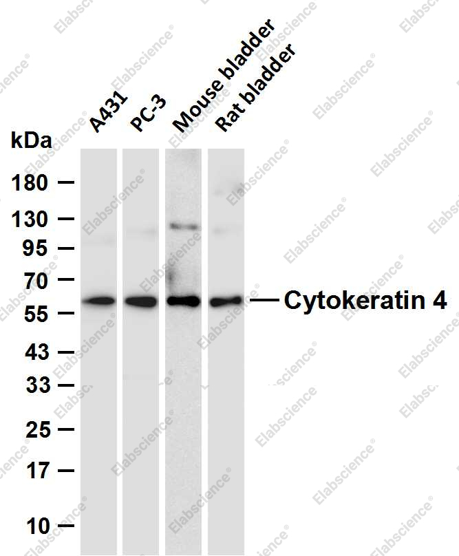 Recombinant Keratin 4 Monoclonal Antibody - 1
