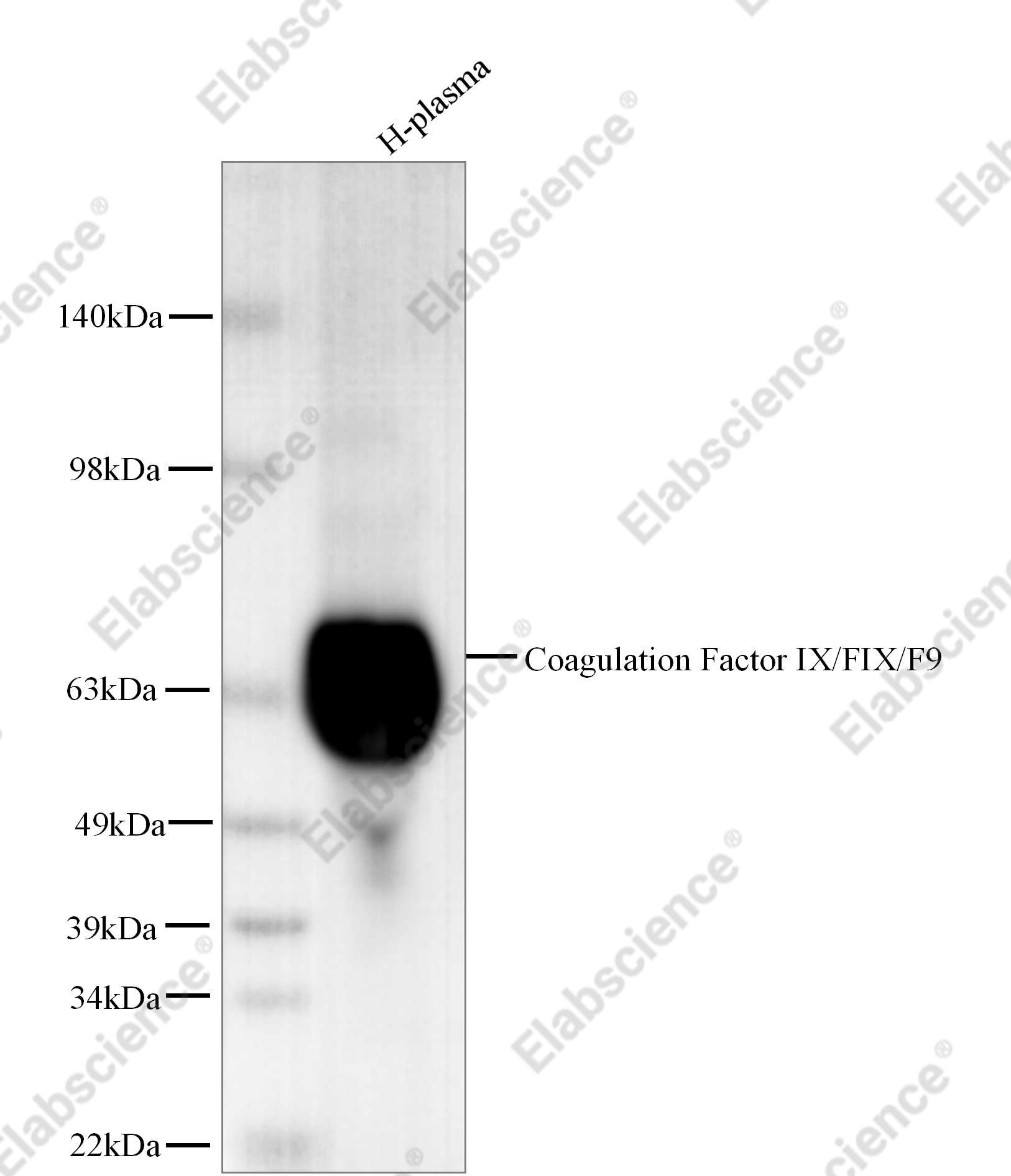 Recombinant Coagulation Factor IX/FIX/F9 Monoclonal Antibody - 1