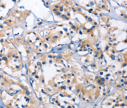 CAPZA2 Polyclonal Antibody - 2