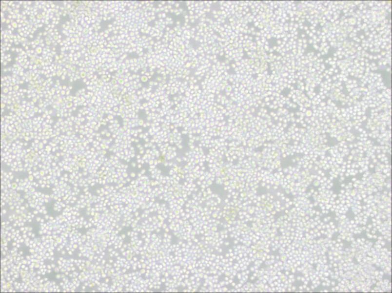 P3X63Ag8 Cell Complete MediumP3X63Ag8 Cell Complete Medium - 2