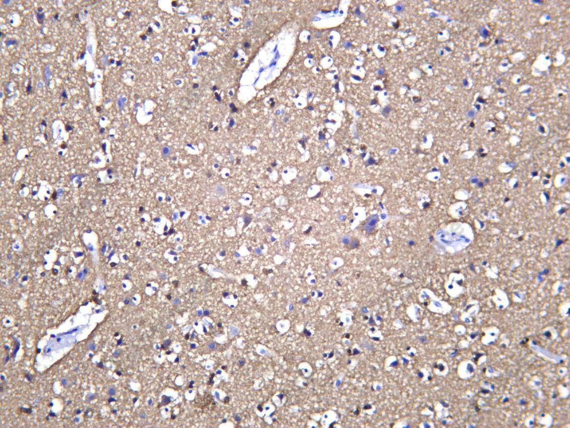 Recombinant TBB4A Monoclonal Antibody - 1