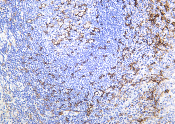 Recombinant CD11c Monoclonal Antibody - small - 2