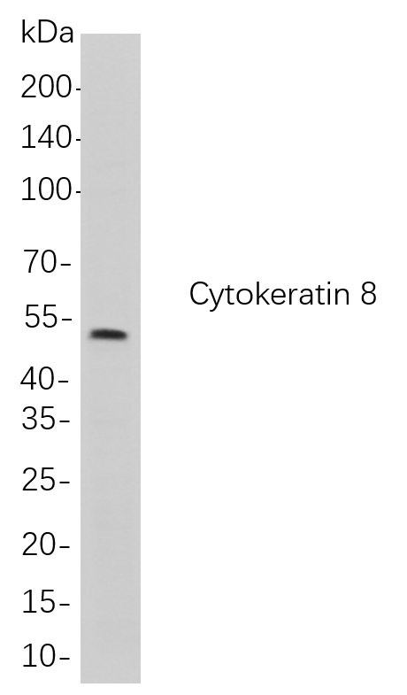 Recombinant Cytokeratin 8 Monoclonal Antibody-searchlist-1