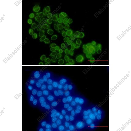 Recombinant RanGAP1 Monoclonal Antibody - 3