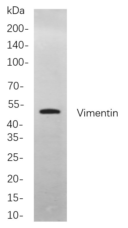 Recombinant Vimentin Monoclonal Antibody-searchlist-1