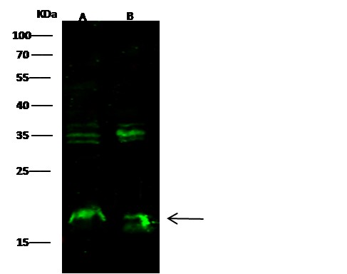 Recombinant Syndecan-4/SDC4 Monoclonal Antibody-searchlist-1