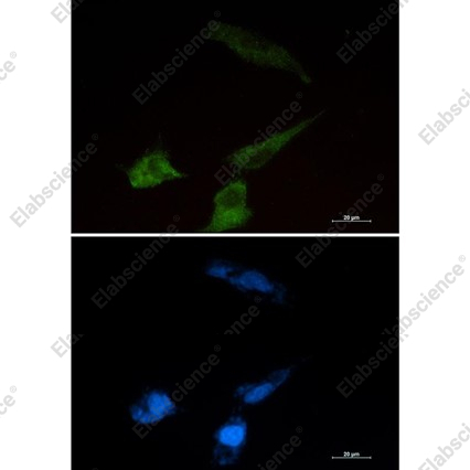 Recombinant NPC2 Monoclonal Antibody - 4