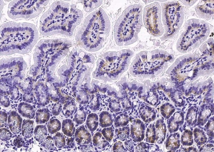 Recombinant Syndecan-4/SDC4 Monoclonal Antibody - small - 3