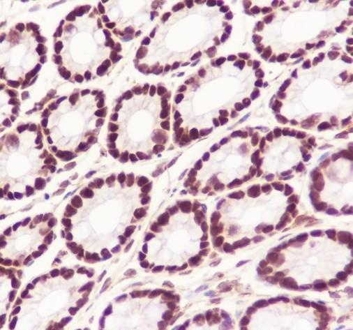 Recombinant SA2 Monoclonal Antibody - small - 5