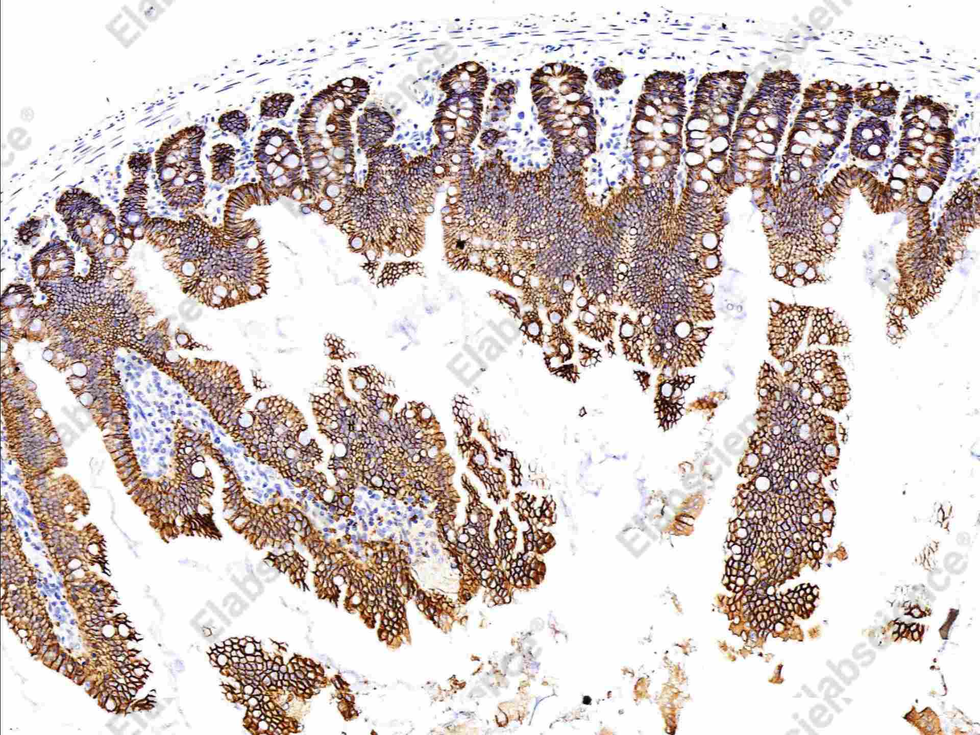 Recombinant EpCAM/TROP-1/TACSTD1 Monoclonal Antibody - 3