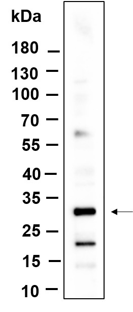 Recombinant KCTD21 Monoclonal Antibody-searchlist-1