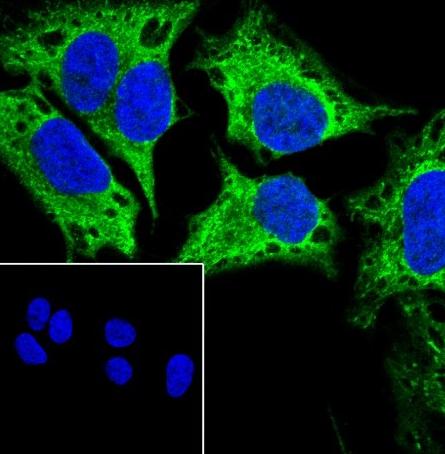 Recombinant RAET1E Monoclonal Antibody - small - 2