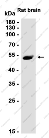Recombinant CUG BP1 Monoclonal Antibody - 1