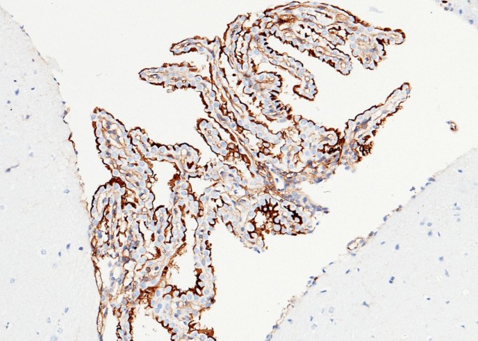 Recombinant ICAM-1/CD54 Monoclonal Antibody - small - 2