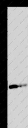 GSTP1 Polyclonal Antibody - 1