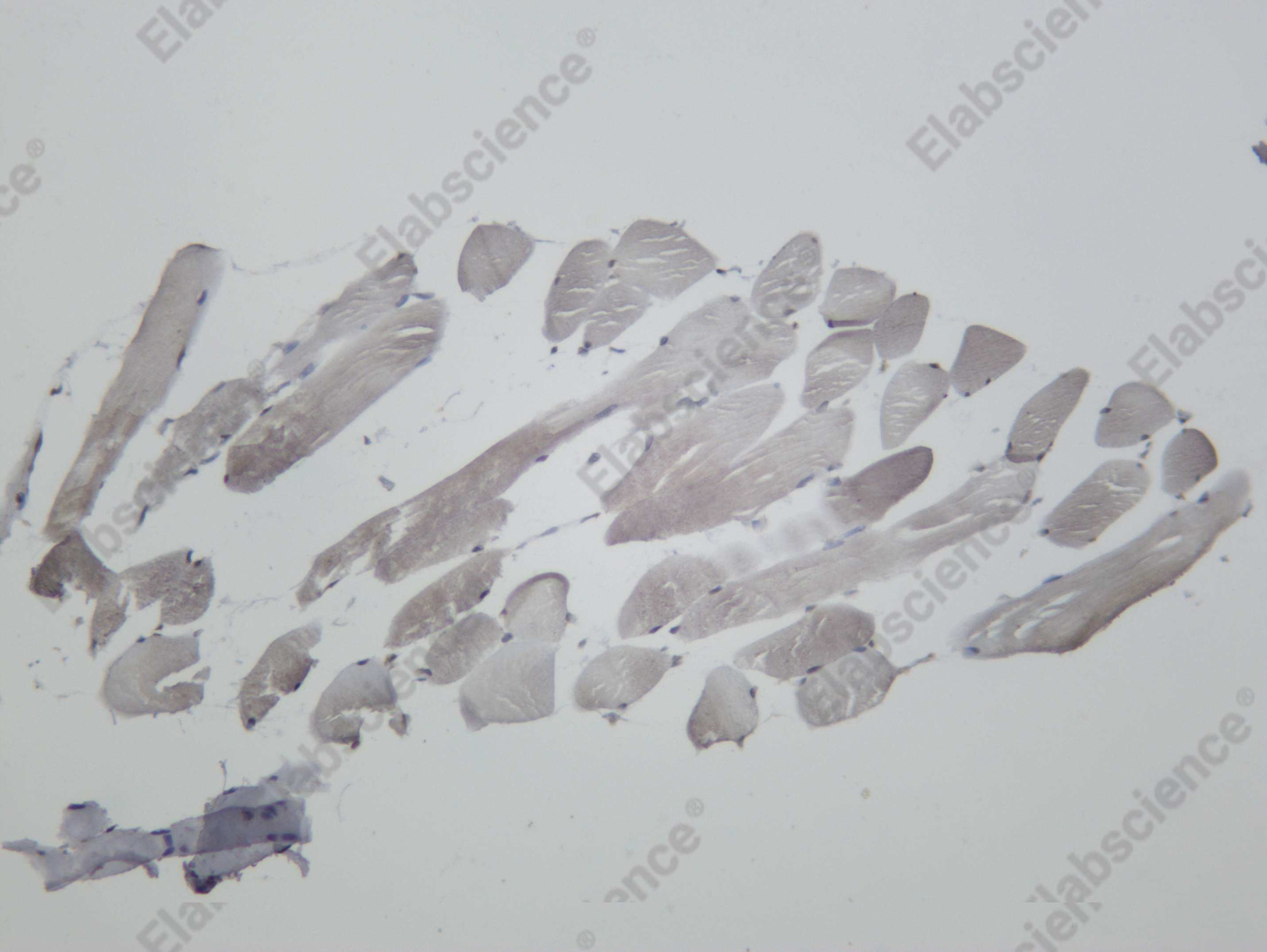 Recombinant IRAK4 Monoclonal Antibody - 5