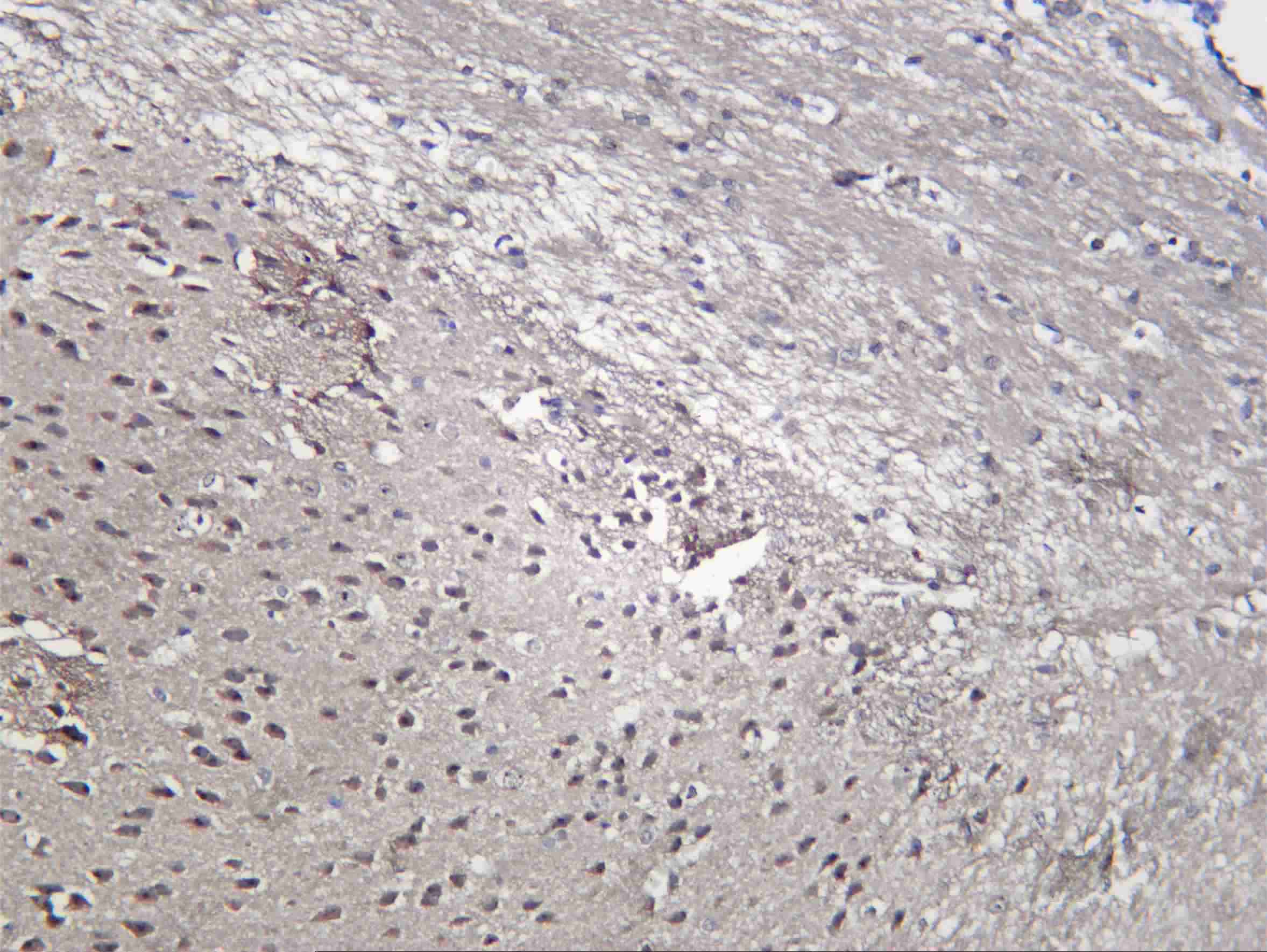 Recombinant ASCL1 Monoclonal Antibody - 1