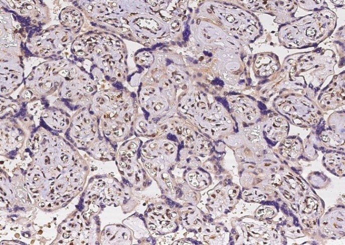 Tie1 Monoclonal Antibody - small - 2