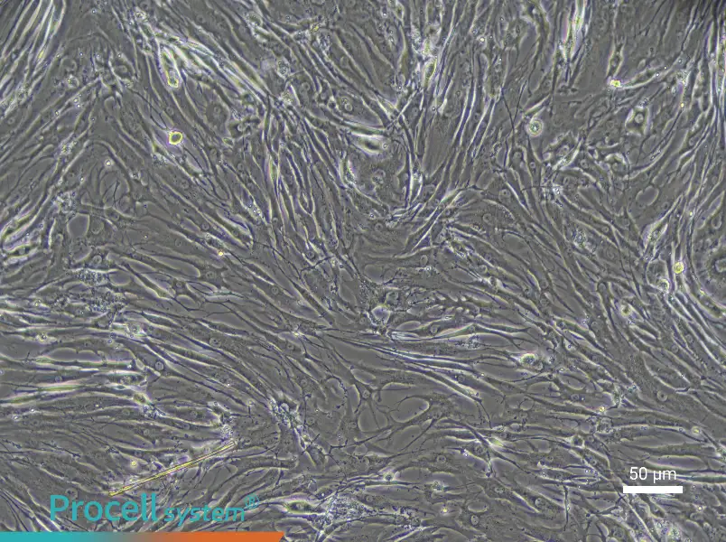 Human Endplate Chondrocyte Complete Medium - 4