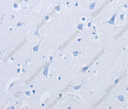 KCNMB3 Polyclonal Antibody - 3