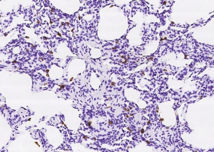 CD68 Monoclonal Antibody - small - 5