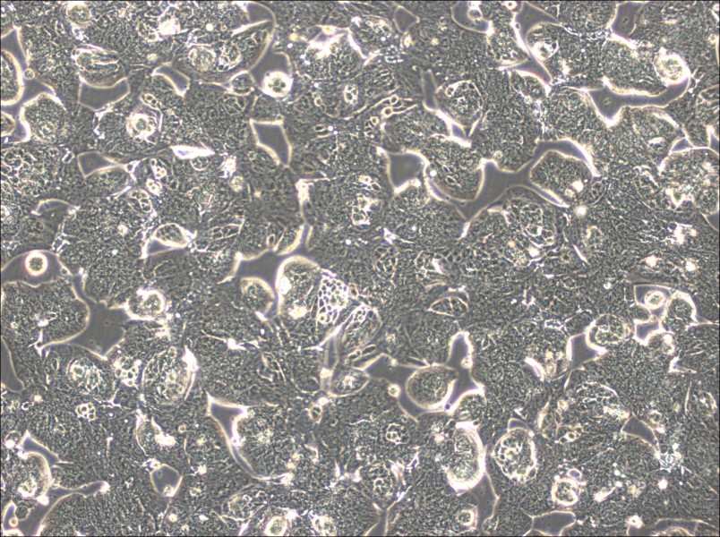 MFE-280 Cell Complete MediumMFE-280 Cell Complete Medium - 2