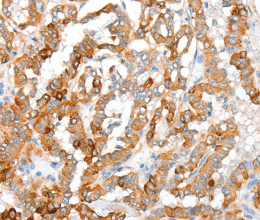 ACY3 Polyclonal Antibody - 2