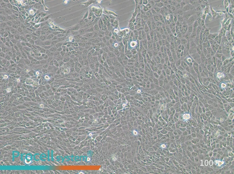 CFPAC-1 Cell Complete Medium - 3